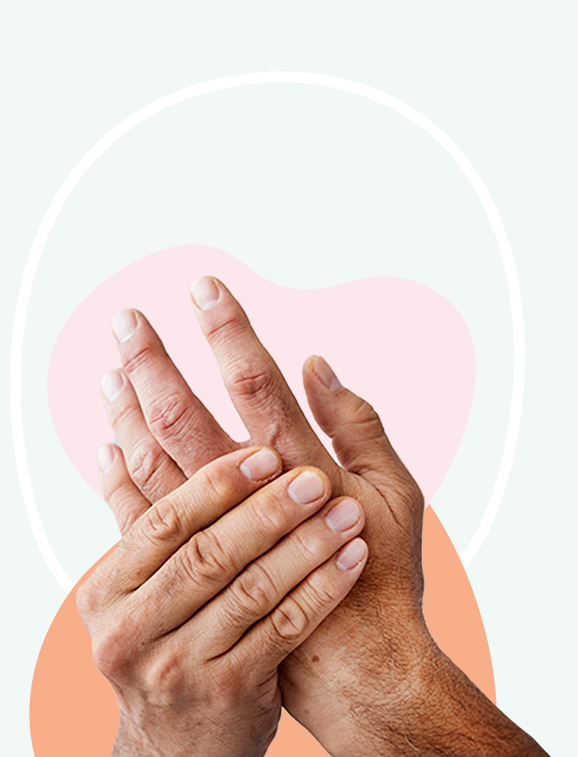 Photo de deux mains atteintes d’arthrose qui se tiennent.